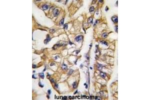 Immunohistochemistry (IHC) image for anti-SLC2A4 Regulator (SLC2A4RG) antibody (ABIN2997830) (SLC2A4RG Antikörper)