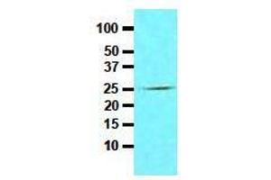 Western Blotting (WB) image for anti-Fas (TNFRSF6)-Associated Via Death Domain (FADD) (AA 1-208), (N-Term) antibody (ABIN317514) (FADD Antikörper  (N-Term))