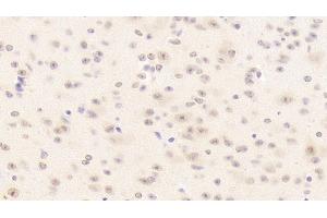 Detection of LRRC32 in Mouse Cerebellum Tissue using Polyclonal Antibody to Leucine Rich Repeat Containing Protein 32 (LRRC32)