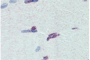 Human Skeletal Muscle: Formalin-Fixed, Paraffin-Embedded (FFPE) (PRDM9 Antikörper  (AA 431-480))