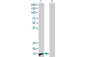 Western Blot analysis of CALCA expression in transfected 293T cell line by CALCA monoclonal antibody (M01), clone 4B10. (CGRP Antikörper  (AA 52-141))