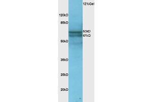 Rat lung lysate probed with Anti Phospho-NFKB p65(Ser276) Polyclonal Antibody, Unconjugated  at 1:3000 for 90 min at 37˚C.