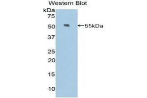 Western blot analysis of the recombinant protein. (KIF5A Antikörper  (AA 823-1027))