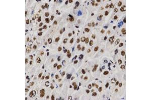 Immunohistochemistry (IHC) image for anti-Proline-, Glutamic Acid- and Leucine-Rich Protein 1 (PELP1) (AA 1021-1180) antibody (ABIN3023502) (PELP1 Antikörper  (AA 1021-1180))