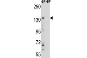 Western blot analysis of JMJD3 antibody and HeLa lysate (Kdm6b Antikörper  (AA 954-987))