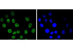 HepG2 cells were stained with Cyclin E1 (4H7) Monoclonal Antibody  at [1:200] incubated overnight at 4C, followed by secondary antibody incubation, DAPI staining of the nuclei and detection. (Cyclin E1 Antikörper)