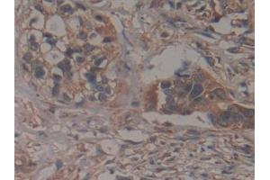 Immunohistochemistry (IHC) image for anti-Glutamate-Cysteine Ligase, Modifier Subunit (GCLM) (AA 40-251) antibody (ABIN7433051)