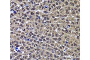 Immunohistochemistry (Paraffin-embedded Sections) (IHC (p)) image for anti-G Protein Pathway Suppressor 1 (GPS1) antibody (ABIN7262819)