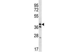 KLF2 antibody western blot analysis in mouse heart tissue lysate. (KLF2 Antikörper  (AA 13-42))