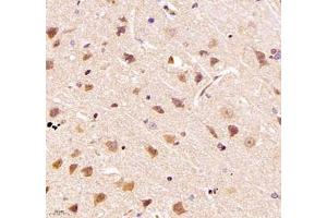 Immunohistochemistry (Paraffin-embedded Sections) (IHC (p)) image for anti-tRNA-YW Synthesizing Protein 1 Homolog B (S. Cerevisiae) (TYW1B) antibody (ABIN7076025)