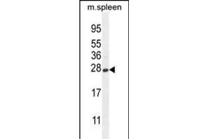 CRYGS Antikörper  (C-Term)