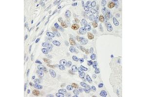 Immunohistochemistry (IHC) image for anti-Proteasome (Prosome, Macropain) 26S Subunit, Non-ATPase, 14 (PSMD14) (AA 1-50) antibody (ABIN7448632)