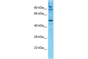 Host:  Rabbit  Target Name:  AMPD1  Sample Type:  293T Whole Cell lysates  Antibody Dilution:  1.