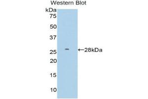 Western Blotting (WB) image for anti-Farnesyl-Diphosphate Farnesyltransferase 1 (FDFT1) (AA 187-416) antibody (ABIN3206186) (FDFT1 Antikörper  (AA 187-416))
