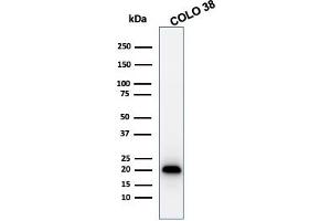 Western Blot Analysis of COLO 38 cell lysate using MART-1 Rabbit Recombinant Monoclonal Antibody (MLANA/1761R). (Rekombinanter MLANA Antikörper)