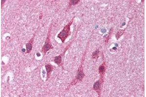 Human Brain, Cortex (formalin-fixed, paraffin-embedded) stained with MRE11A antibody ABIN214028 at 5 ug/ml followed by biotinylated goat anti-rabbit IgG secondary antibody ABIN481713, alkaline phosphatase-streptavidin and chromogen.