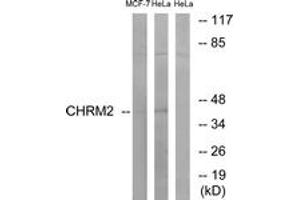 Western Blotting (WB) image for anti-Cholinergic Receptor, Muscarinic 2 (CHRM2) (AA 185-234) antibody (ABIN2890806) (Muscarinic Acetylcholine Receptor M2 Antikörper  (AA 185-234))