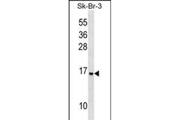Urotensin 2B Antikörper  (N-Term)