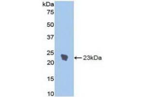 Detection of Recombinant IL1R1, Rat using Polyclonal Antibody to Interleukin 1 Receptor Type I (IL1R1) (IL1R1 Antikörper  (AA 386-553))