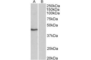 Image no. 1 for anti-TATA Box Binding Protein (TBP) (AA 2-12) antibody (ABIN1104605) (TBP Antikörper  (AA 2-12))