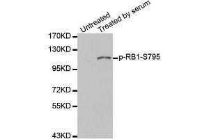 Western blot analysis of extracts of 293 cell line, using phospho-RB-S795 antibody (ABIN5969932). (Retinoblastoma 1 Antikörper  (pSer795))