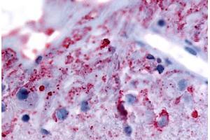Human Eye, Ganglion Cells (formalin-fixed, paraffin-embedded) stained with GRM6 antibody ABIN213492 at 5. (Metabotropic Glutamate Receptor 6 Antikörper  (N-Term))