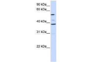 WB Suggested Anti-SLC25A16 Antibody Titration:  0.