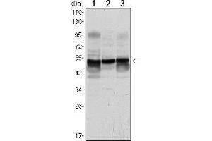 Western blot analysis using GFAP mouse mAb against A431 (1), SK-N-SH (2) and PC12 (3) cell lysate. (GFAP Antikörper)