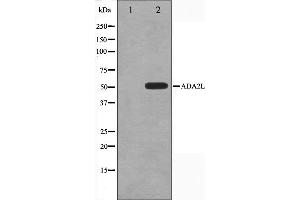 Western blot analysis on COLO205 cell lysate using ADA2L Antibody,The lane on the left is treated with the antigen-specific peptide. (TADA2L Antikörper)