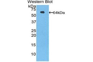 Western Blotting (WB) image for anti-serine Peptidase Inhibitor, Kazal Type 5 (SPINK5) (AA 734-995) antibody (ABIN1860611) (SPINK5 Antikörper  (AA 734-995))