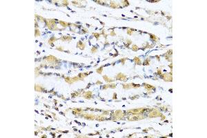 Immunohistochemistry of paraffin-embedded human stomach using GNRH1 antibody (ABIN5973277) at dilution of 1/100 (40x lens). (GNRH1 Antikörper)