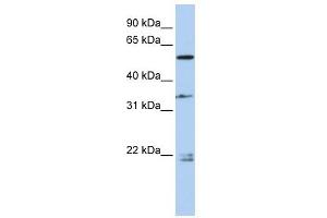 DPYSL2 antibody used at 1 ug/ml to detect target protein. (DPYSL2 Antikörper  (Middle Region))