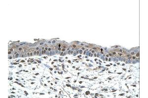 CENPA antibody was used for immunohistochemistry at a concentration of 4-8 ug/ml. (CENPA Antikörper  (N-Term))