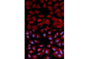 Immunofluorescence analysis of U2OS cells using PSMC4 antibody. (PSMC4 Antikörper  (AA 1-165))