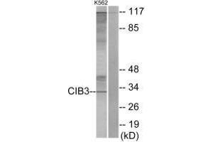 Western blot analysis of extracts from K562 cells, using CIB3 antibody. (CIB3 Antikörper  (C-Term))