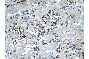 SCD antibody was used for immunohistochemistry at a concentration of 4-8 ug/ml to stain Hepatocytes (arrows) in Human liver. (SCD Antikörper)