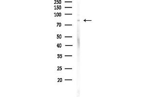 anti-Carnitine Palmitoyltransferase 1C (Brain) (CPT1C) antibody