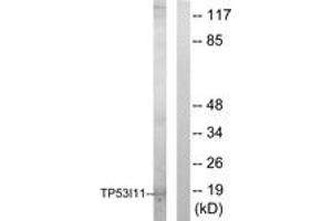 Western blot analysis of extracts from HuvEc cells, using TP53I11 Antibody. (TP53I11 Antikörper  (AA 71-120))