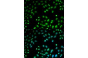 Immunofluorescence analysis of U2OS cells using PI antibody (ABIN6128449, ABIN6145593, ABIN6145595 and ABIN6221396). (PIAS1 Antikörper  (AA 422-651))