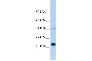 REG1B antibody used at 1 ug/ml to detect target protein. (REG1B Antikörper  (N-Term))