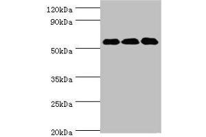 Western blot All lanes: XIAP antibody at 3 μg/mL Lane 1: HepG2 whole cell lysate Lane 2: MCF-7 whole cell lysate Lane 3: PC-3 whole cell lysate Secondary Goat polyclonal to rabbit IgG at 1/10000 dilution Predicted band size: 57 kDa Observed band size: 57 kDa (XIAP Antikörper  (AA 1-200))