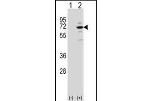 Western blot analysis of MeCP2 (arrow) using rabbit polyclonal MeCP2 Antibody (E11) (ABIN650708 and ABIN2839305). (MECP2 Antikörper  (N-Term))
