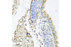 Immunohistochemistry of paraffin-embedded mouse lung using CTSK antibody (ABIN5970899) at dilution of 1/100 (40x lens). (Cathepsin K Antikörper)