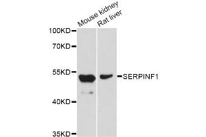 Western blot analysis of extracts of various cell lines, using SERPINF1 Antibody (ABIN5998782) at 1/1000 dilution. (PEDF Antikörper)
