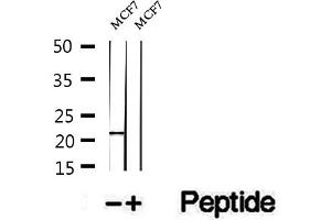 Western blot analysis of extracts of MCF7 cells, using PTP4A1/PRL1 antibody. (PTP4A1 Antikörper  (C-Term))