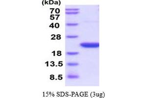 SDS-PAGE (SDS) image for Peptidylprolyl Isomerase F (PPIF) (AA 30-206) (Active) protein (His tag) (ABIN6387945)