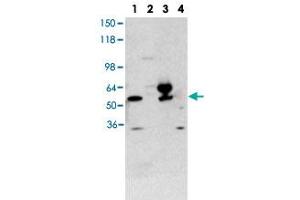 Western blot using THRA polyclonal antibody  shows detection of purified recombinant THRA (lane 1) and THRA present in a 293 cell lysate after transient transfection with THRA (lane 3).