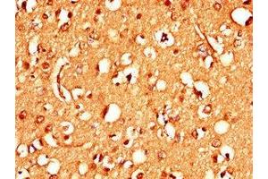 Immunohistochemistry of paraffin-embedded human brain tissue using ABIN7170837 at dilution of 1:100