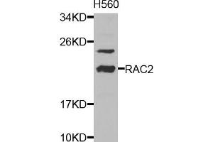 Western blot analysis of extracts of HL-60 cells, using RAC2 antibody (ABIN5970487) at 1/1000 dilution. (RAC2 Antikörper)