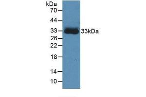 Detection of Recombinant CA4, Human using Monoclonal Antibody to Carbonic Anhydrase IV (CA4) (CA4 Antikörper  (AA 19-283))